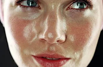 Segredo de avó que foi presa por não ter rugas humilha dermatologistas