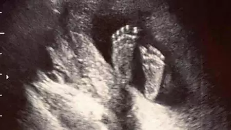 [Pics] Texas Mom Thinks She's Having A Baby, Then She Sees The Ultrasound Scan