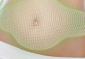 מדהים: מוצר ההרזיה החדש שהעולם מגלה