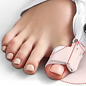 Here's why people over 45 are snapping up this bunion corrector