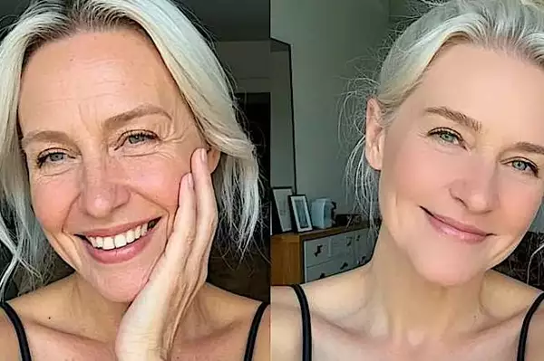 Pessoas com flacidez no rosto devem ler isto Pessoas com flacidez no rosto devem ler isto