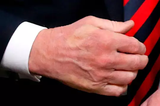 Firm friends? Macron handshake leaves mark on Trump