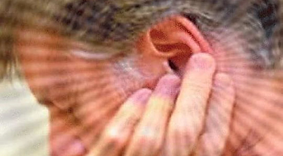 Ringing Ears? When Tinnitus Won't Stop, Try This (Watch)