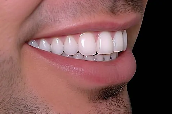 Τι επιδοτεί ο ΕΟΠΥΥ για οδοντικά εμφυτεύματα στην Ελλάδα