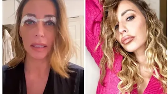Karina Cascella dopo la blefaroplastica: “Via le palpebre da pesce lesso”