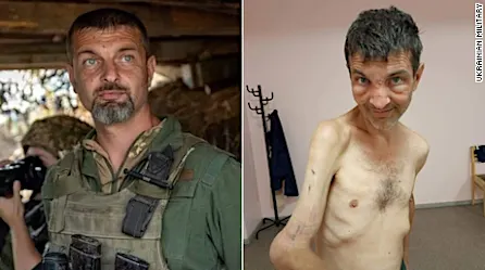 Perturbador: el antes y después de un soldado ucraniano tras ser liberado del cautiverio ruso