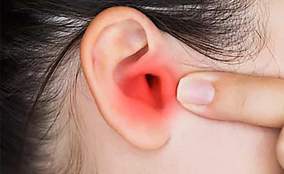 Doctor: if You Have Tinnitus (Ear Ringing) Do This Immediately!