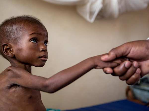 30,000円のご支援が子どもたちの栄養治療食892袋分へと変わります