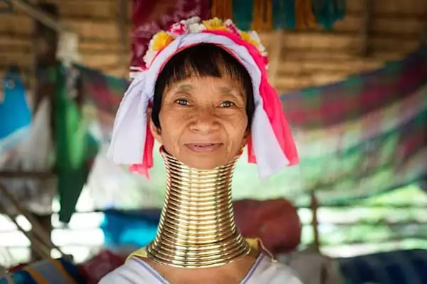 [Fotos] Mujer jirafa finalmente se quita los anillos después de cinco años