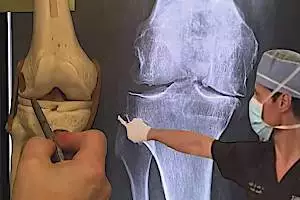 Orthopedic Surgeon Shares His Brilliant Trick To Help With Knee Pain From Home (Instant Relief)