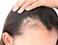 1 Stop Solution For Hair Loss.Try It Now!