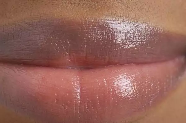 If you have dark lips try these 2 natural remedies