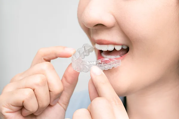 Search For Custom Teeth Retainer Replacement