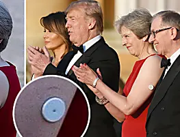 Donald Trump visit: What does Theresa May have on her arm? Why is she wearing a patch?