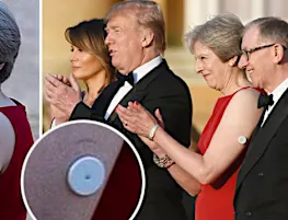 Donald Trump visit: What does Theresa May have on her arm? Why is she wearing a patch?