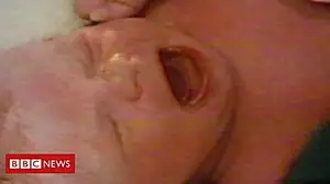'I helped deliver world's first IVF baby'