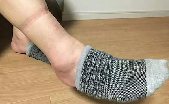 La thérapie idéale contre la neuropathie à la maison (c’est brillant !)