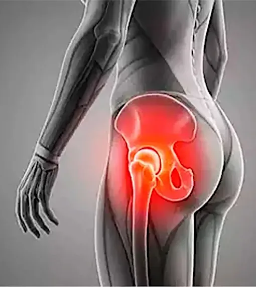 Why Your Sciatic Nerve Won't Heal (What Most Doctors Miss)