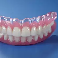 Τι καλύπτει ο ΕΟΠΥΥ για εμφυτεύματα δοντιών στην Ελλάδα