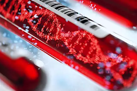 LiquidCell Dx Developing Tumor Microenvironment Liquid Biopsy to Predict ICI Therapy Response