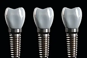 何でも噛める幸せをもう一度「インプラントガイドブックを無料でプレゼント」申込累計500,000部突破