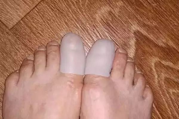 英國頂尖足科醫生：如果你患有腳趾甲真菌感染，今晚就試試這個（效果絕佳）