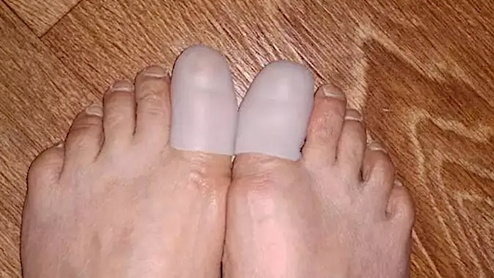 Selbst der älteste Nagelpilz kann in 3 Tagen verschwinden