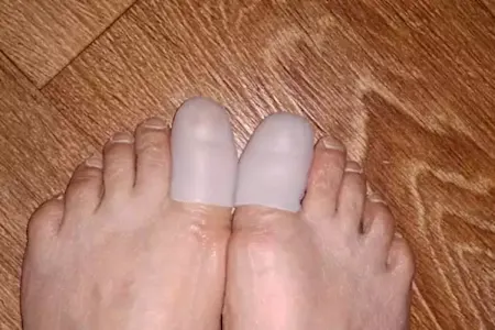 Doctor: This Is the Simple 2026 Trick for Nail Fungus (It’s Genius)