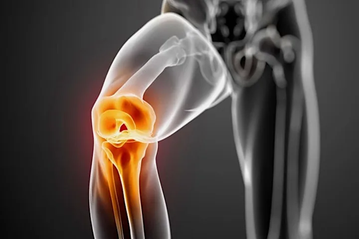 Jika lutut dan pinggul terasa sakit, ambillah