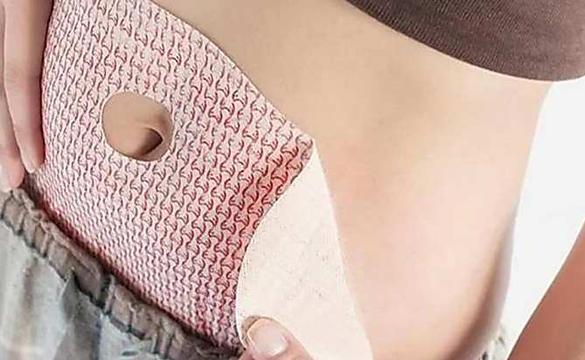 These liposuction patches are winning the hearts of the English