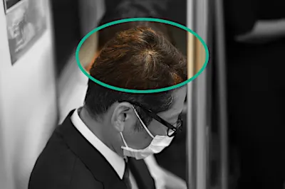「頭頂部が薄くなってきたら」バスクリンが快挙！有効成分生薬100%の育毛剤を開発