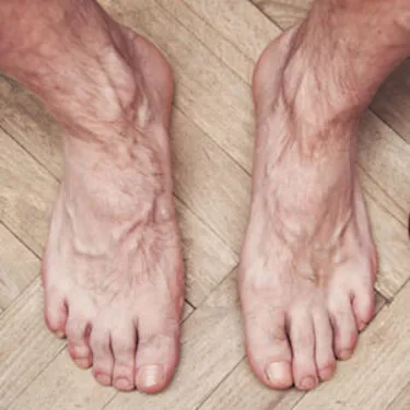 Simple Method To Reduce Neuropathy (Watch)