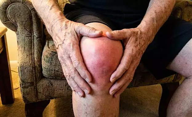 Knee Arthritis: A Simple Tip For Pain Relief
