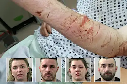 Horrific injuries of football coach after thugs carved 'nonse' on his back