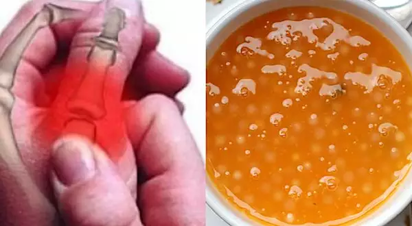Sopa criada por santa há 1400 anos pode tratar dores articulares?