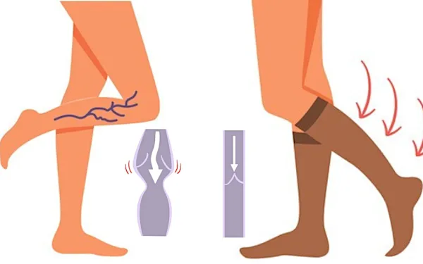 Incroyable : les séniors s’arrachent ces nouvelles chaussettes, voici la raison !