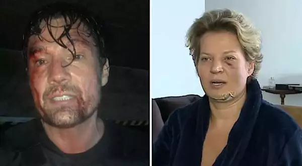 Ator aparece com rosto ferido e ironiza Joice: ‘Sofri um atentado’
