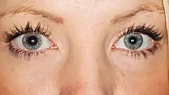 You can learn a lot about your health from eye color