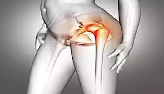 Οι άνθρωποι με πόνο στα γόνατα και στους γοφούς πρέπει να το διαβάσουν αυτό