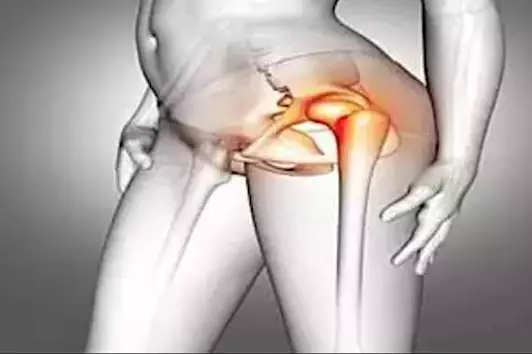 Οι άνθρωποι με πόνο στα γόνατα και στους γοφούς πρέπει να το διαβάσουν αυτό