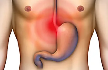 GI Doctor Cautions: "Never Do This If You Have Heartburn"