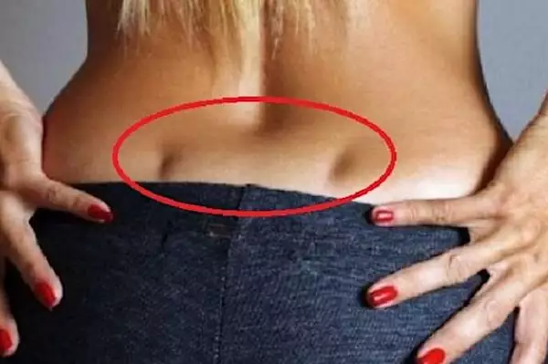 Venus Holes On Your Back: What They Reveal About You