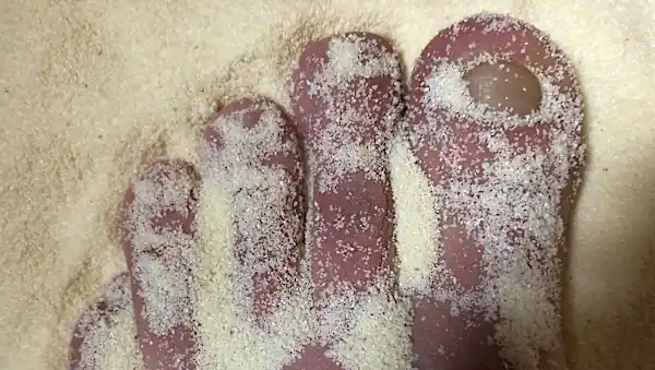 Toenail Fungus? Do This Daily And Watch What Happens