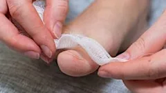 Simple Way To Reduce Toenail Fungus? (Watch)