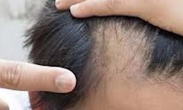 Doing This Before Bed Could Help Your Hair Growth (Watch This)