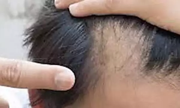 Doing This Before Bed Could Help Your Hair Growth (Watch This)