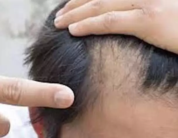 Doing This Before Bed Could Help Your Hair Growth (Watch This)