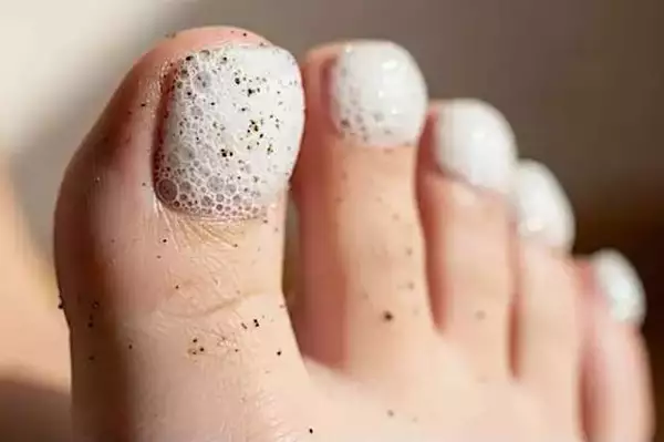 Ο γιατρός δεν μπορεί να εξηγήσει, αλλά αυτό μπορεί να κάνει τον μύκητα των νυχιών να εξαφανιστεί Ο γιατρός δεν μπορεί να εξηγήσει, αλλά αυτό μπορεί να κάνει τον μύκητα των νυχιών να εξαφανιστεί