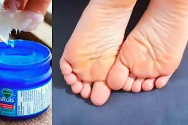 Rub Vicks VapoRub On Your Feet At Night, Here's Why