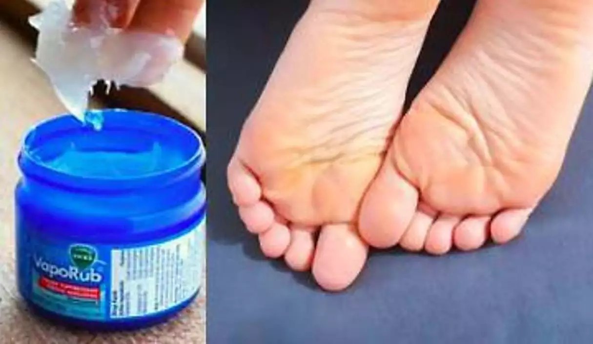 Rub Vicks VapoRub On Your Feet At Night, Here's Why